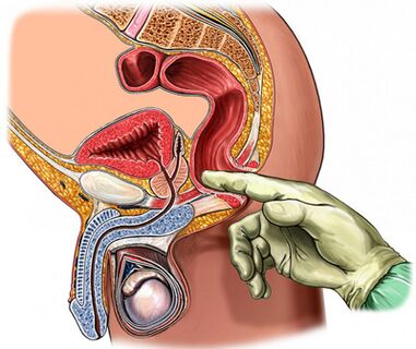 Digital prostate examination