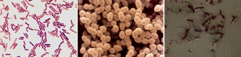 Escherichia coli, fajis enterococcus and proteus chronic bacterial prostatitis are the main reasons
