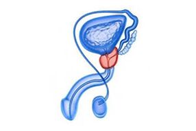 drawings of prostatitis