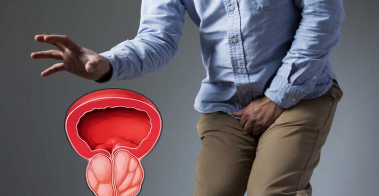 Prevention of prostatitis and prostate adenom